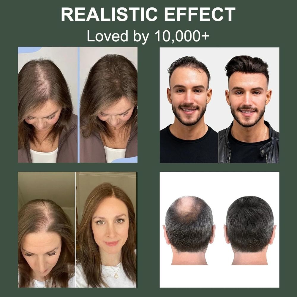 Rosmarin-Aminosäure Koreanisch – Hair Care Korean Bewertung und Preis